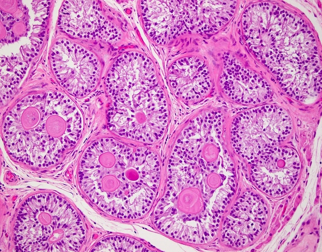 Ảnh hiển vi mô học gồm nhiều nang và cấu trúc tuyến tròn